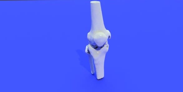 Top 10 Free Downloadable 3d Knee Model And Other Stl Files 3d