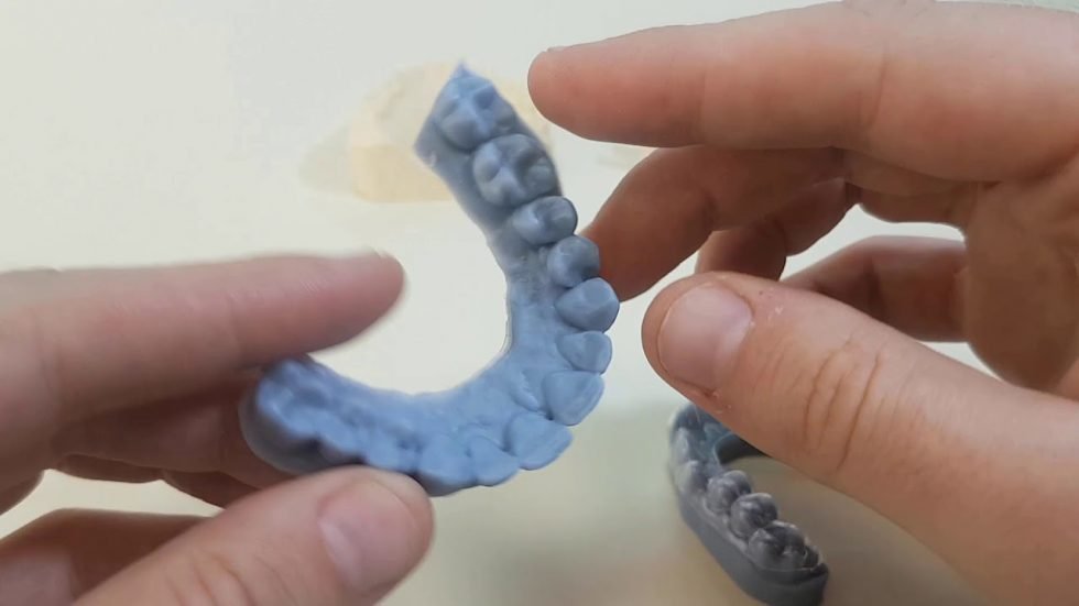 3D printing dental models material comparison and tips 3D Printing